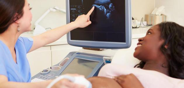 ما هى اشعة الموجات الصوتية الثلاثية الابعاد